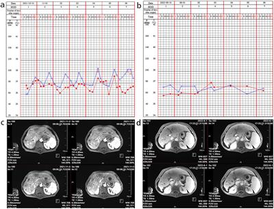 Case report: Detection of non-O1/non-O139 Vibrio cholerae in a patient with hepatic space-occupying lesions using metagenomic next-generation sequencing